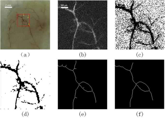 圖:真實的血管圖像 圖:真實的血管圖像