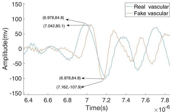 使用折射率板后脈管系統的光聲信號 使用折射率板后脈管系統的光聲信號